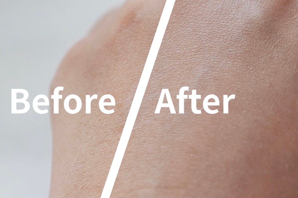 薬用ホワイトコンク ホワイトニングCC CII/ホワイトコンク/ボディクリームを使ったクチコミ(4枚目)