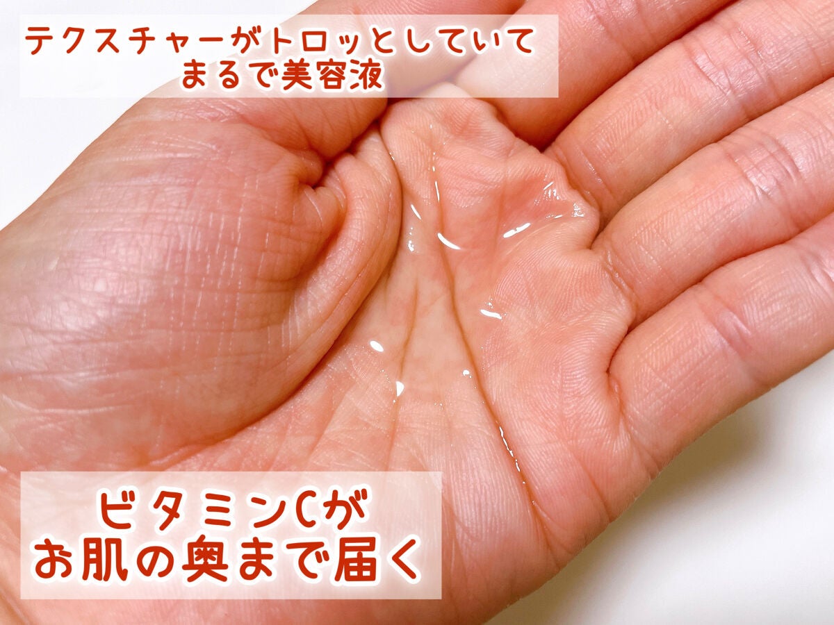 VC100エッセンスローション EX/ドクターシーラボⓇ/化粧水を使ったクチコミ(3枚目)