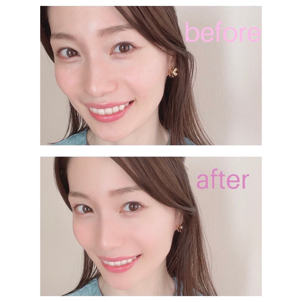 スマスリフト　ウルセラタンリフト　ファンデーション　5点セット スマスリフト / ウルセラタンリフトキットの公式商品情報｜美容