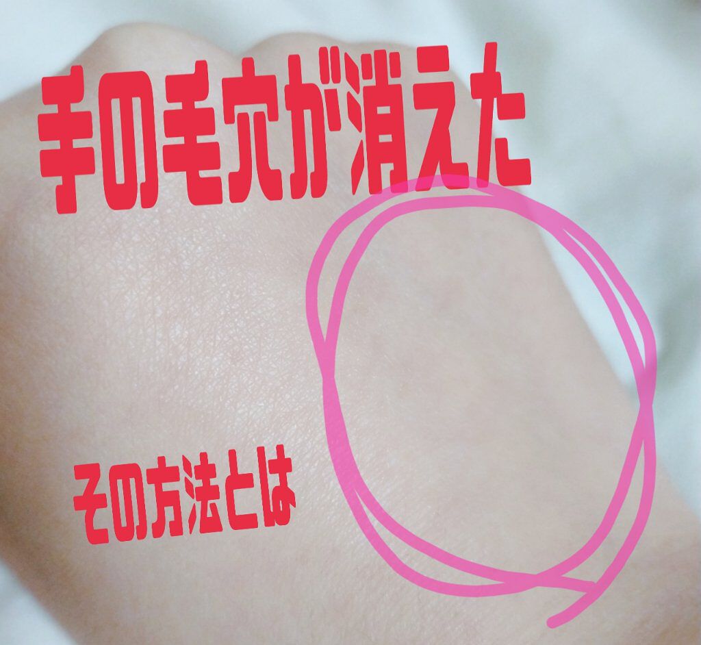 トーンアップ ハンドクリーム/コエンリッチQ10/ハンドクリームを使ったクチコミ（1枚目）