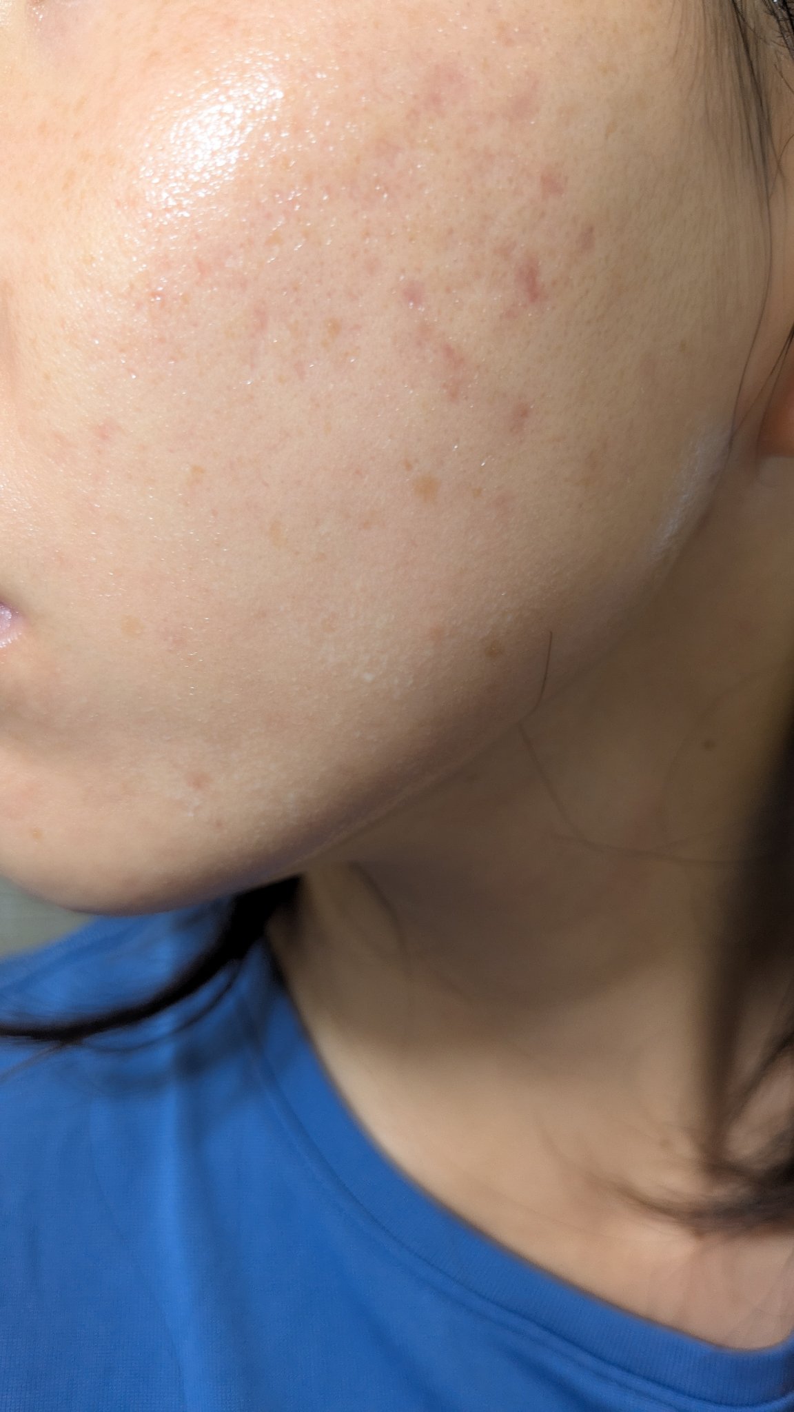 薬用リンクルナイトクリーム ホワイト/なめらか本舗/フェイスクリームを使ったクチコミ（2枚目）