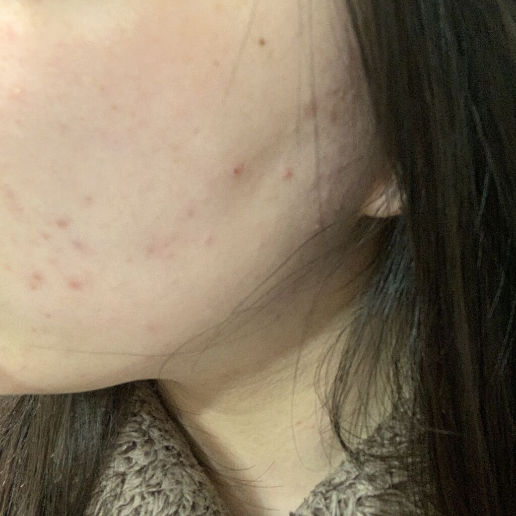 明色美顔水 薬用化粧水/美顔/化粧水を使ったクチコミ（2枚目）