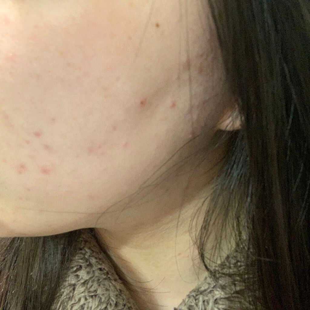 チョコラBBプラス (医薬品)/チョコラBB/その他を使ったクチコミ(2枚目)