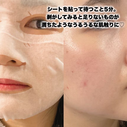 FAS ザ ブラック デイリー シートマスク/FAS/シートマスク・パックを使ったクチコミ(5枚目)