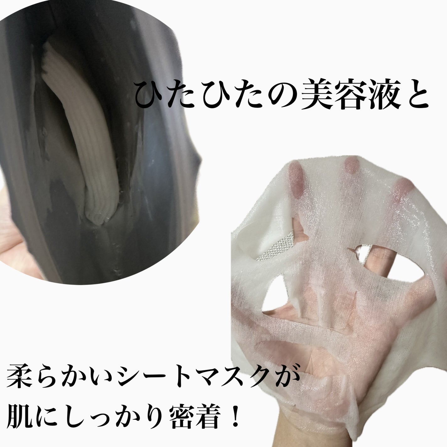 ごめんね素肌 キニナルマスク/クリアターン/シートマスク・パックを使ったクチコミ(2枚目)