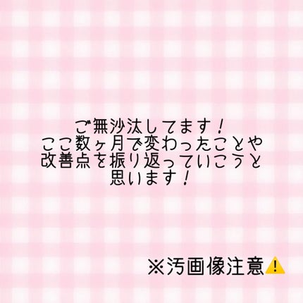 カラミー カラミンノーセバムローション/Calamee/化粧水を使ったクチコミ(1枚目)