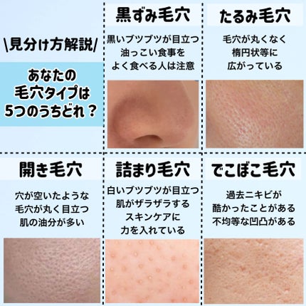 ソフティモ スピーディ クレンジングオイル/ソフティモ/オイルクレンジングを使ったクチコミ(4枚目)