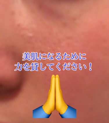 mimi on LIPS 「助けてください！！！！お姉様方！！初投稿失礼します！私は14歳..」（1枚目）