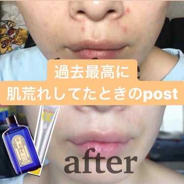 おまめ💅 on LIPS 「こんにちは、まめです！いつもいいね、コメントありがとうございま..」（2枚目）