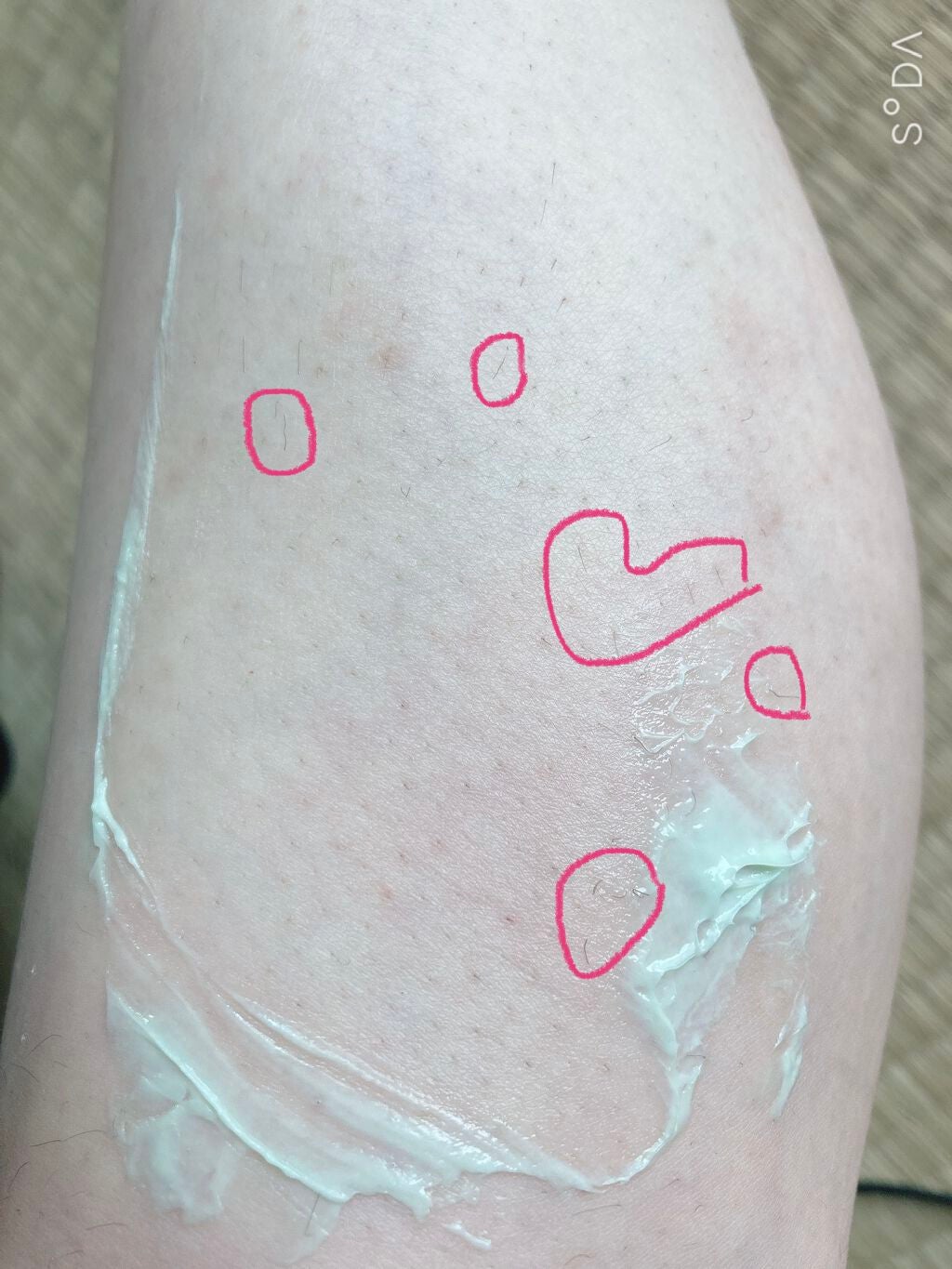 リムーバーフラペ/スージースタンド/除毛クリームを使ったクチコミ(5枚目)