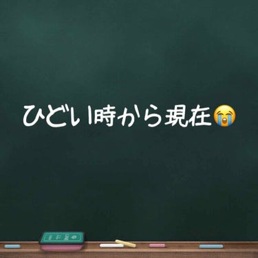 あやりんご🍎 on LIPS 「やっとここまで治ってきた🥺本当に途中挫折しそうだったし、毎日が..」（1枚目）