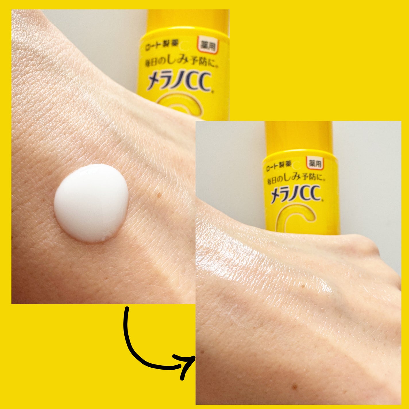 みあん on LIPS 「ロート製薬さまからいただきました😊∞-------------..」(7枚目)