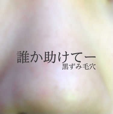 女子力低めのさくらんぼ on LIPS 「皆さん助けてー何しても治らない黒ずみ毛穴治す方法を教えて下さい..」（1枚目）