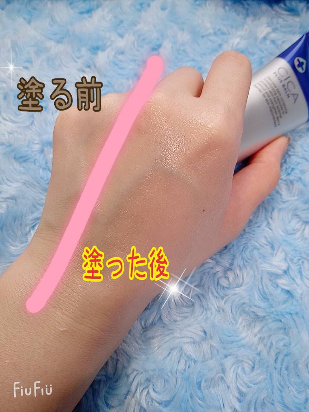 デュイセル シカプラスバーム/DEWYCEL/フェイスクリームを使ったクチコミ(1枚目)