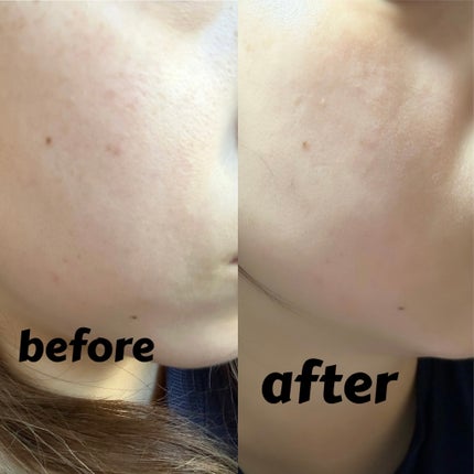 リードル ショット リフティング アイ クリーム/VT/アイケア・アイクリームを使ったクチコミ(2枚目)