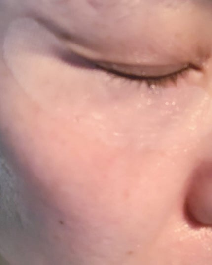 リクエス コンセントレート チャージ パッチ/クラブ/シートマスク・パックを使ったクチコミ(5枚目)