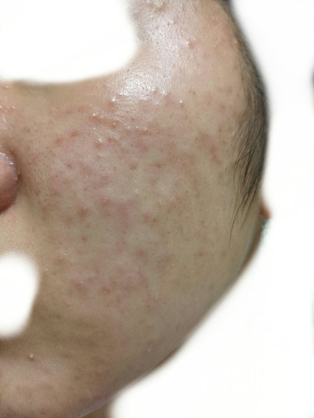 いやりんぐ on LIPS 「学校帰りの肌です。朝は「お!調子いいじゃん?」って思っても学校..」(3枚目)