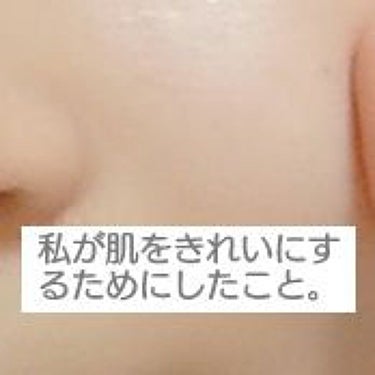 さ。 on LIPS 「肌が綺麗な人っていいですよね。ニキビのない肌にしたい！と思った..」（1枚目）