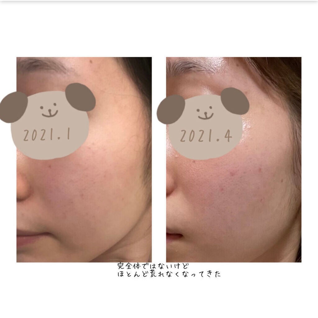 ザ・タイムR アクア/IPSA/化粧水を使ったクチコミ(7枚目)