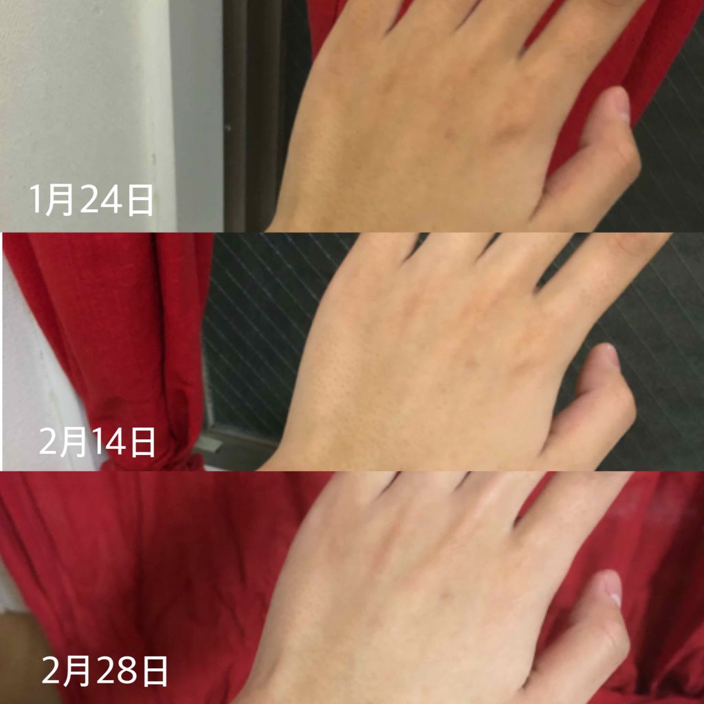 メラノCC 薬用しみ集中対策液(旧)/メラノCC/美容液を使ったクチコミ（2枚目）