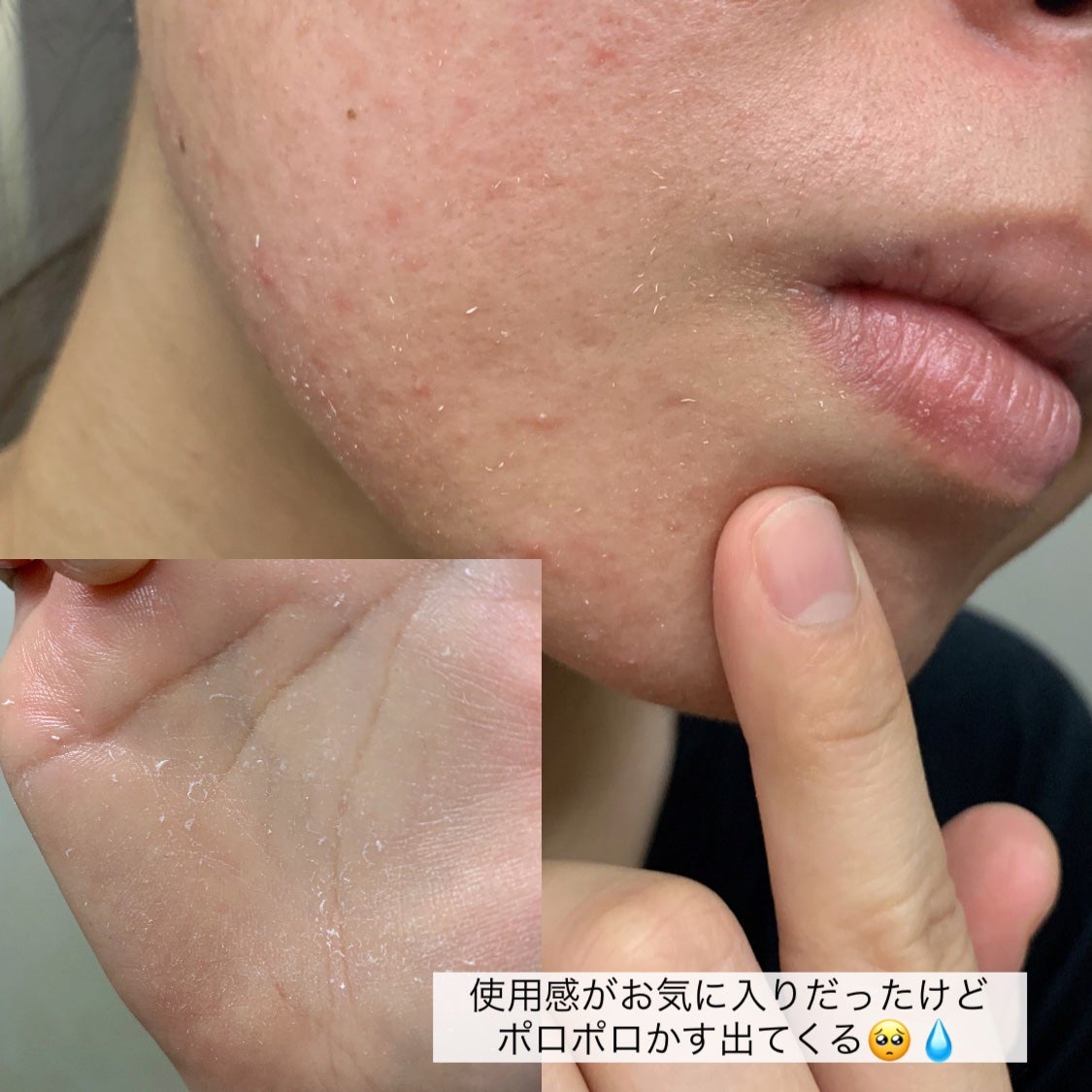 ニベアUV ディープ プロテクト&ケア ジェル/ニベア/日焼け止めジェルを使ったクチコミ(8枚目)