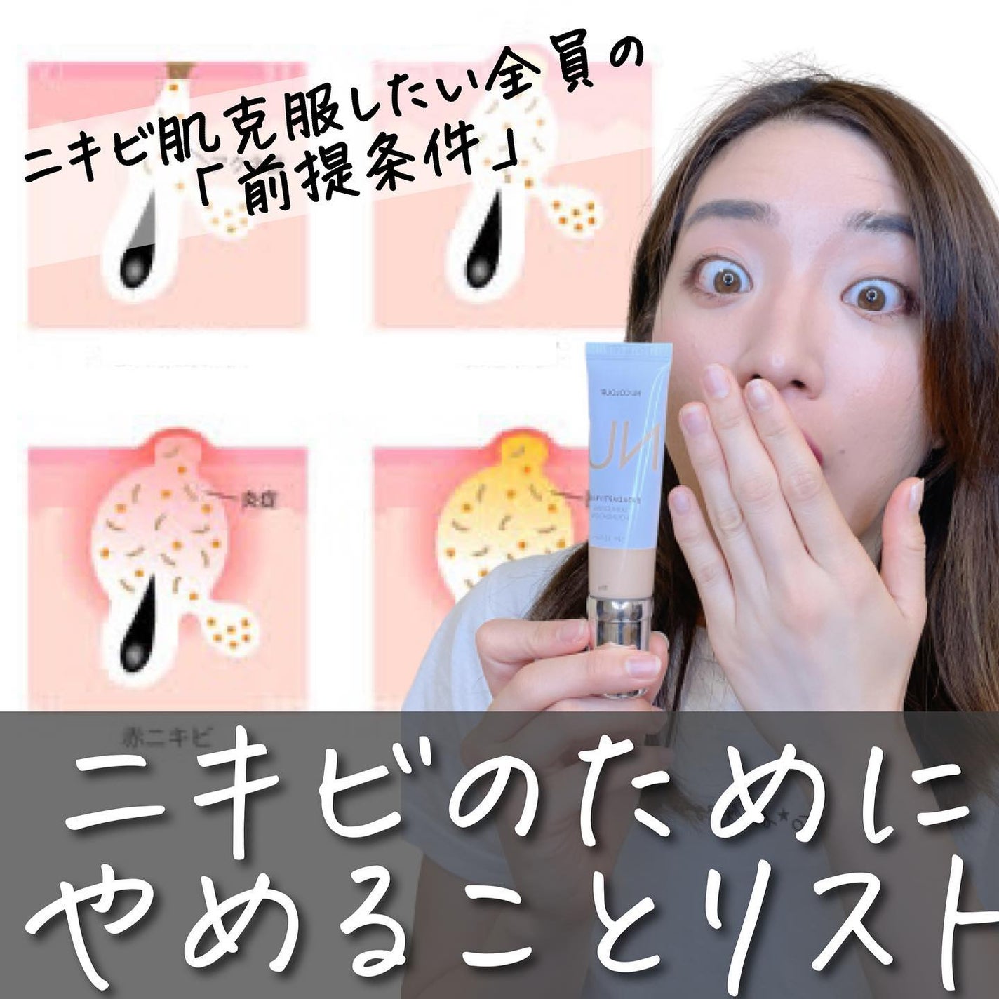 おゆみ|ニキビ・ニキビ跡ケア on LIPS 「【楽してニキビは治りません】こんばんは。「やめることリスト..」(1枚目)