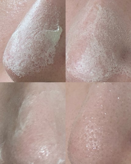 カナディアンクレイ ポア クレンザー/NEOGEN/洗い流すパック・マスクを使ったクチコミ(4枚目)