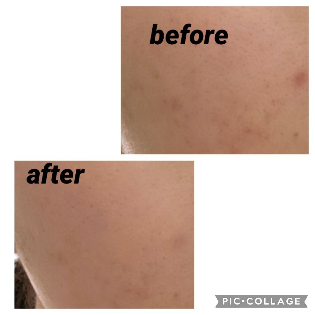 フローレス ルミエール ラディアンス パーフェクティング クッション 1N1(2021 リミテッド エディション)/ローラ メルシエ/クッションファンデーションを使ったクチコミ（2枚目）