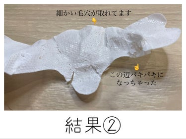 毛穴モップ (3STEP NOSE PACK)/YAMMY’S TOY/洗い流すパック・マスクを使ったクチコミ（5枚目）