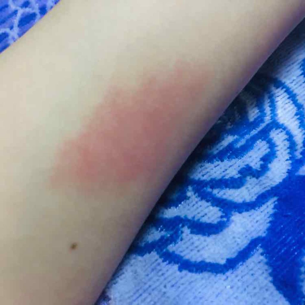 チャビー スティック モイスチャライジング リップ カラー バーム/CLINIQUE/口紅を使ったクチコミ（2枚目）