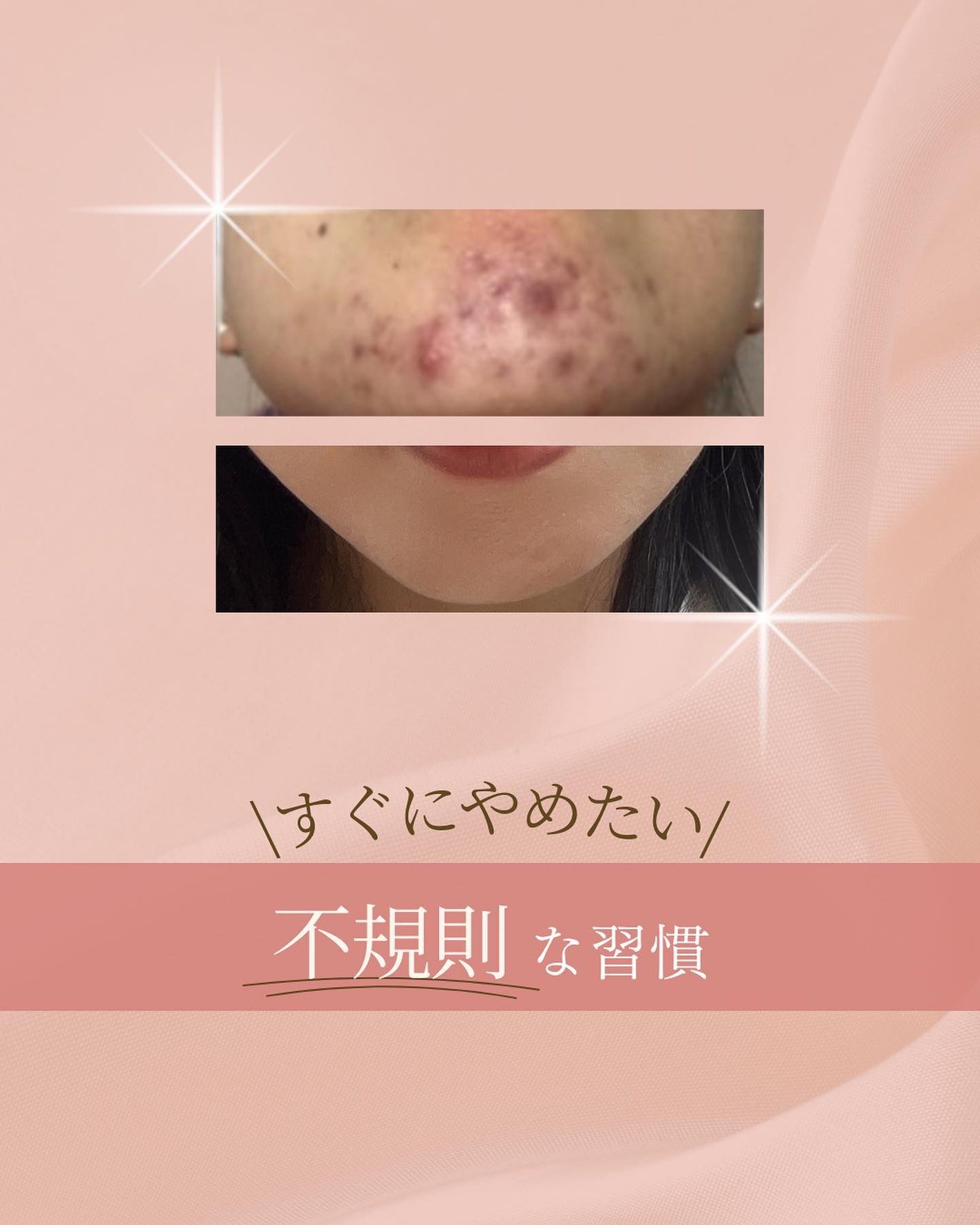 ã¿ãð¹ on LIPS ãðèªåã倧äºã«æ±ããããã«ãããã/äžèŠåãªç¿æ
£ð¡âªïžã€ãã€ã..ãïŒ1æç®ïŒ