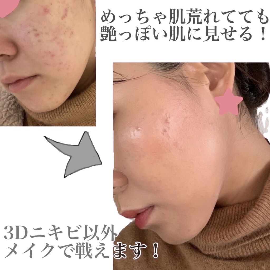 スタジオフィックス フルイッド SPF 15/M・A・C/リキッドファンデーションを使ったクチコミ（1枚目）