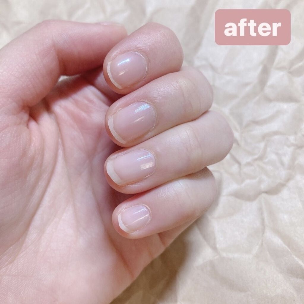 ディーアップファンデーション/D-UP/ネイルベースコートを使ったクチコミ（3枚目）