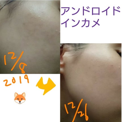 薬用 しみ 集中対策 美容液/メラノCC/美容液を使ったクチコミ(3枚目)