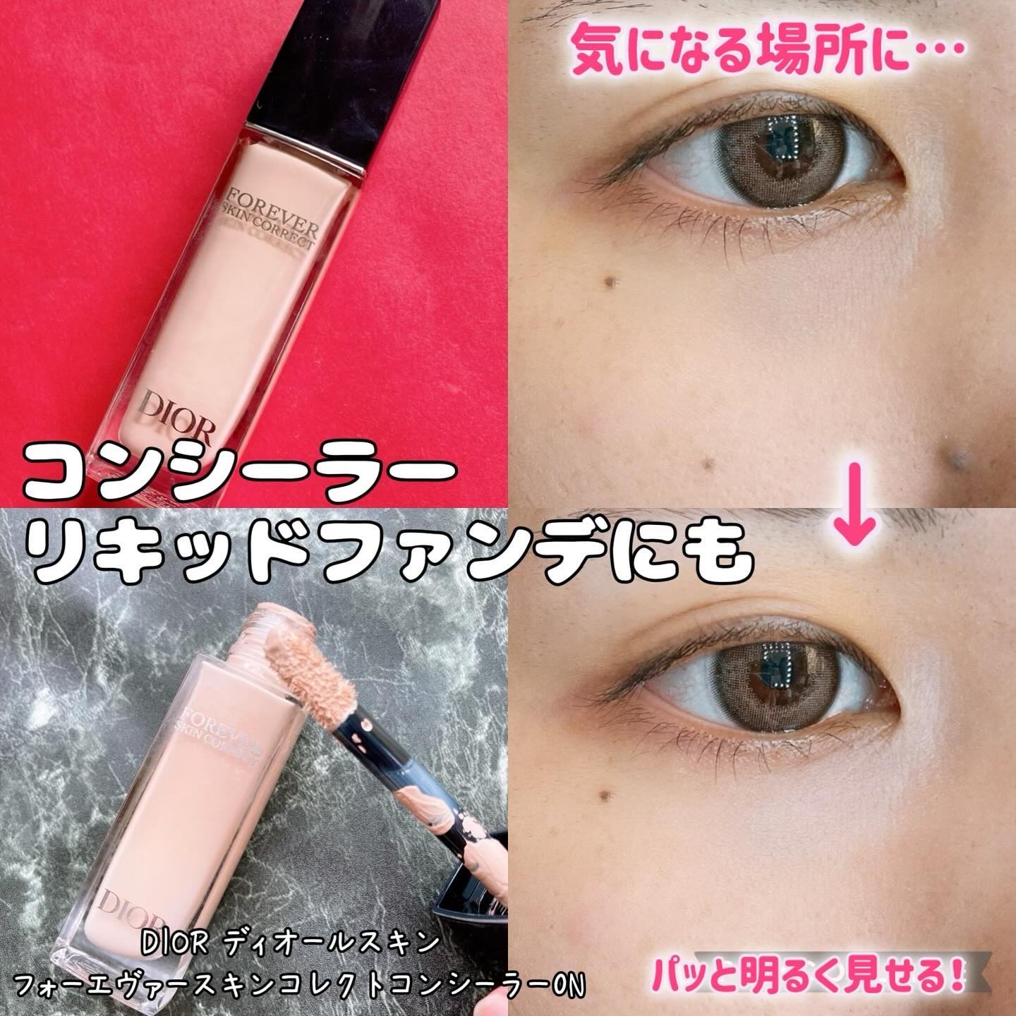 ディオールスキン フォーエヴァー スキン コレクト コンシーラー 0Nニュートラル/Dior/リキッドコンシーラーを使ったクチコミ（1枚目）
