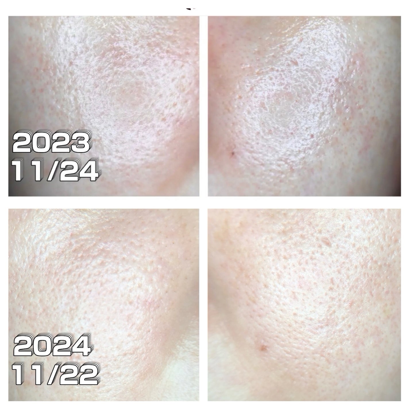 水溶性フラーレン/TOUT VERT/美容液を使ったクチコミ(6枚目)