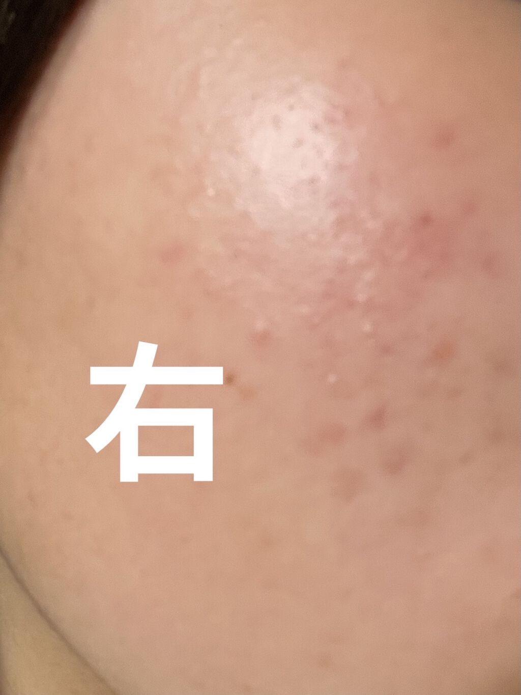 ハイジドルフジェル アロエ/ハイジドルフ/ボディローションを使ったクチコミ（2枚目）