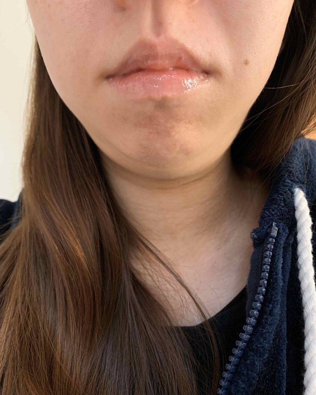 ハニーフルリップ HM/カントリー&ストリーム/リップ美容液を使ったクチコミ（3枚目）