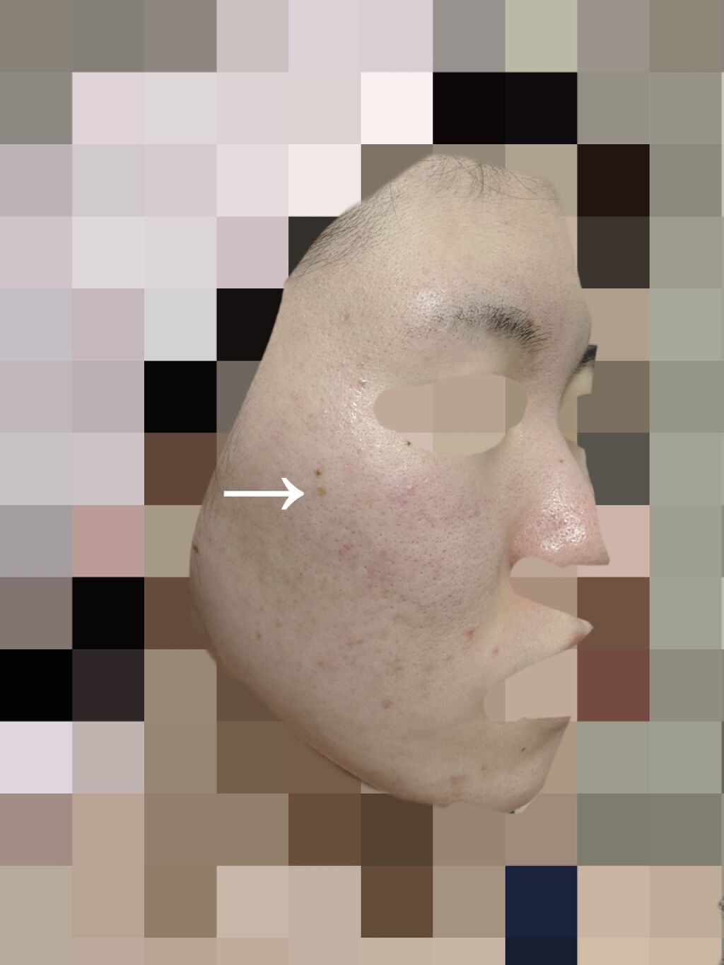 薬用 クリアローション M(しっとりタイプ)/オルビス/化粧水を使ったクチコミ（2枚目）