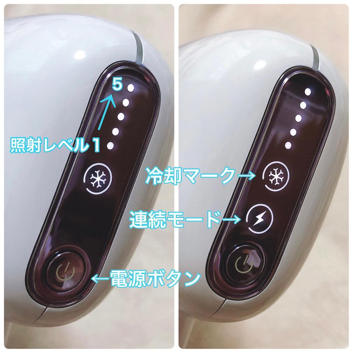 サファイアIPL脱毛器 /yete/家庭用脱毛器を使ったクチコミ(4枚目)