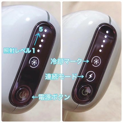 サファイアIPL脱毛器 /yete/家庭用脱毛器を使ったクチコミ(4枚目)