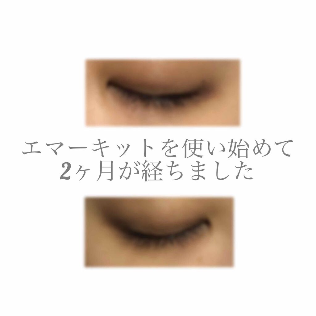 EMAKED（エマーキット）/水橋保寿堂製薬/まつげ美容液を使ったクチコミ（1枚目）