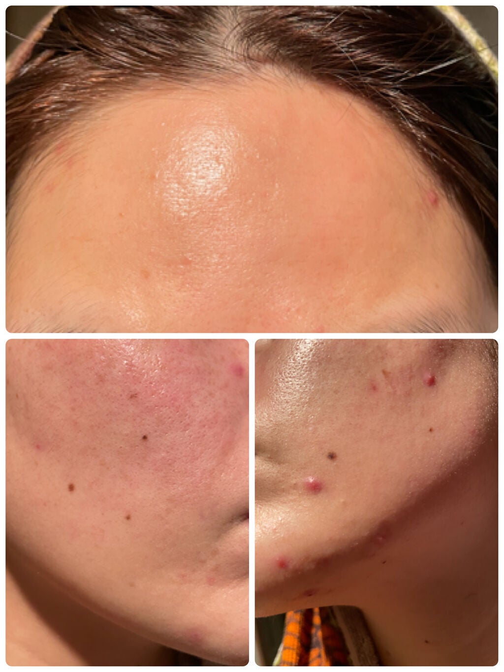 セラムコンサントレエクレルシサン/クレ・ド・ポー ボーテ/美容液を使ったクチコミ(3枚目)