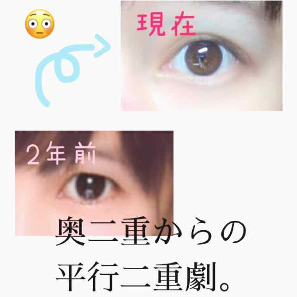 アイトーク/アイトーク/二重まぶた用アイテムを使ったクチコミ(1枚目)