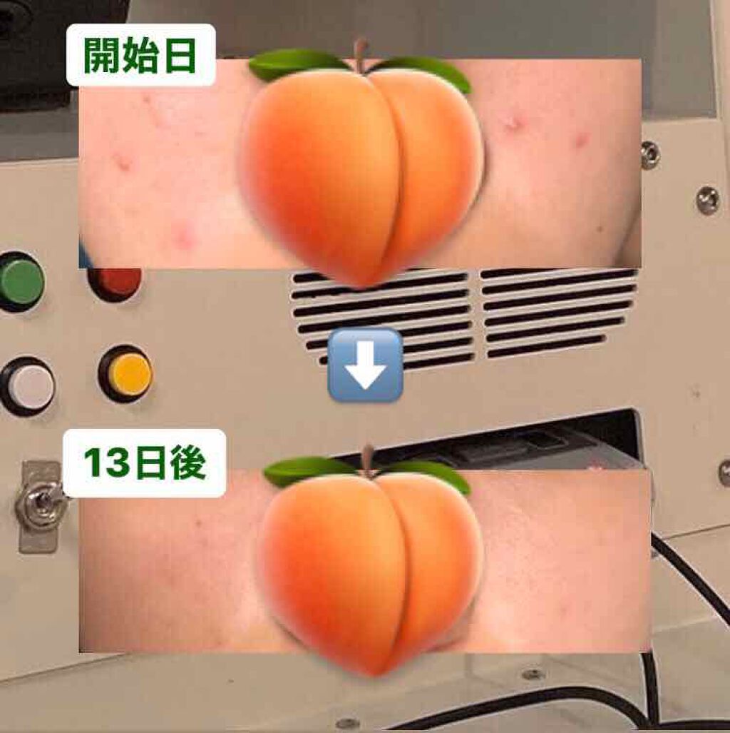 潤い化粧水/ももぷり/化粧水を使ったクチコミ（2枚目）