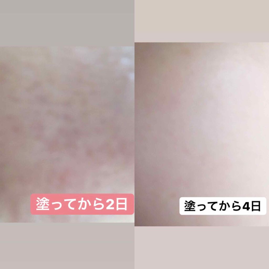 ハトムギ化粧水(ナチュリエ スキンコンディショナー R )/ナチュリエ/化粧水を使ったクチコミ(2枚目)