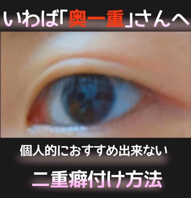 こんばんは。
☆私の二重奮闘記1⃣
ナイトアイボーテを使う前までのお話。
激重一重の方へ、1意見として参考になればと
思います。

※画像の目は数週間ほど前のもの(すっぴん)です。画質荒くてすみません。