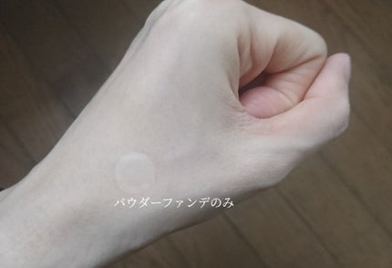 クリアパッチ/Angelab/にきびパッチを使ったクチコミ(8枚目)