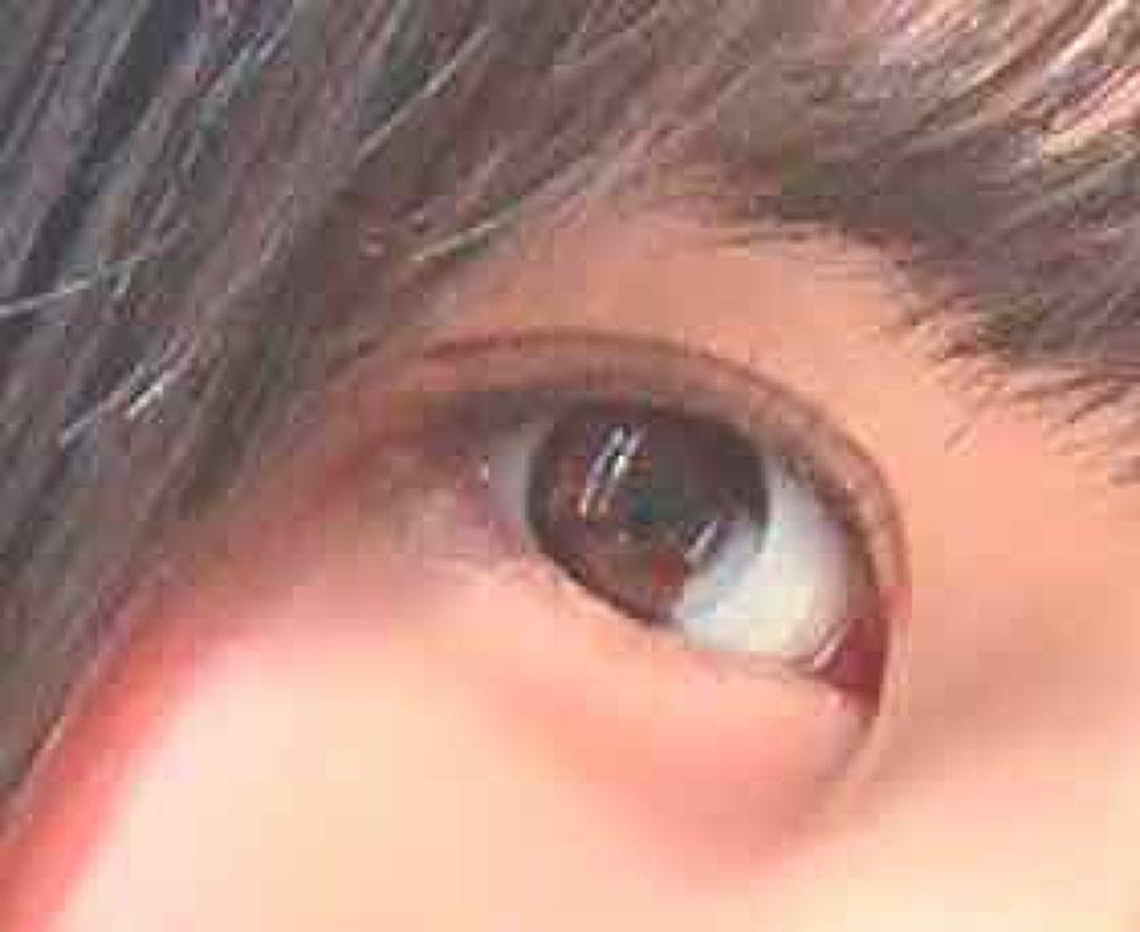 ロートリセ(医薬品)/ロート製薬/その他を使ったクチコミ(2枚目)