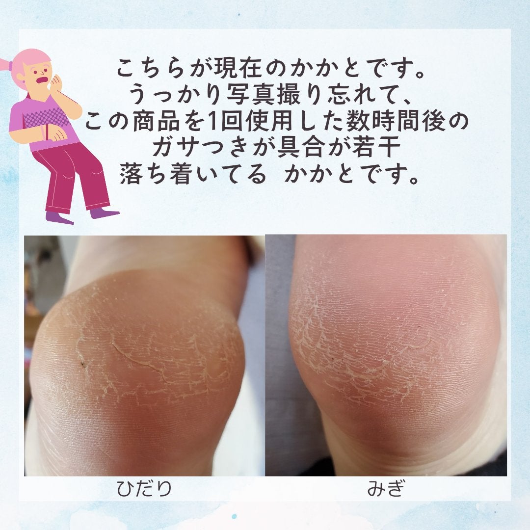 ぺろてぃ on LIPS 「本日の購入品紹介👣/ダイソーゲルかかとソックス税込み220円商..」(4枚目)